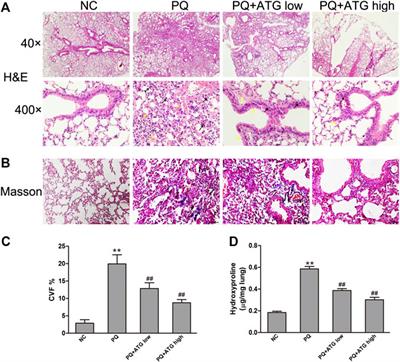 Arctigenin Suppressed Epithelial-Mesenchymal Transition Through Wnt3a/β-Catenin Pathway in PQ-Induced Pulmonary Fibrosis